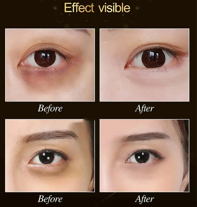 Neville Derma Lab EX NMN+ 逆齡美肌煥顏眼霜 20ml